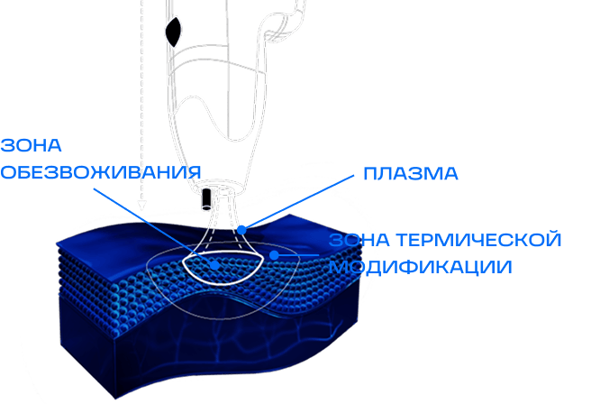 Зоны воздействия